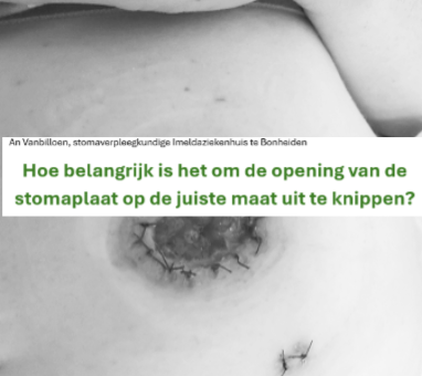 Hoe belangrijk is het om de opening van de stomaplaat op de juiste maat uit te knippen?